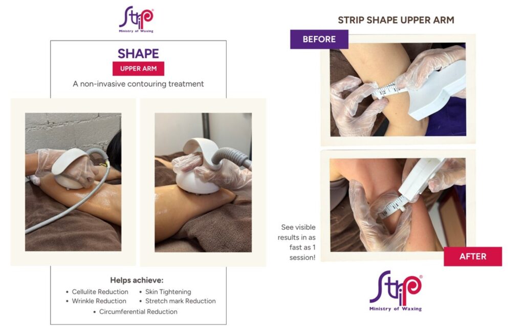 Achieve a More Sculpted Silhouette with Strip Shape, Strip Manila's Non-Invasive Body Contouring Treatment shape 3